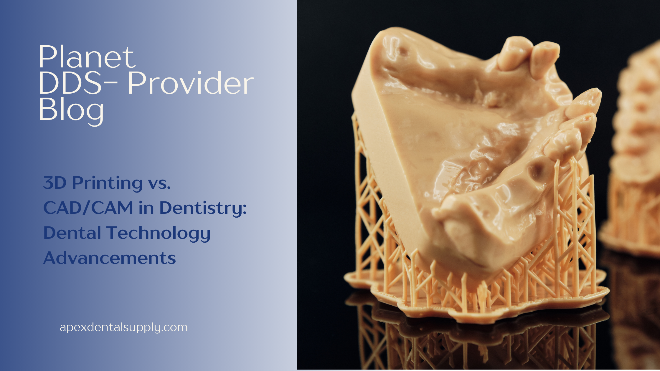 Dental Technology Advancements: 3D Printing vs. CAD/CAM – APEX DENTAL ...