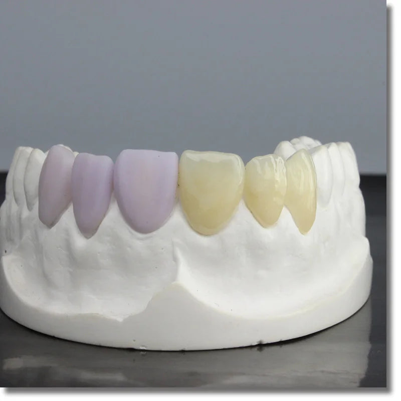 CEREC CADCAM Blocks