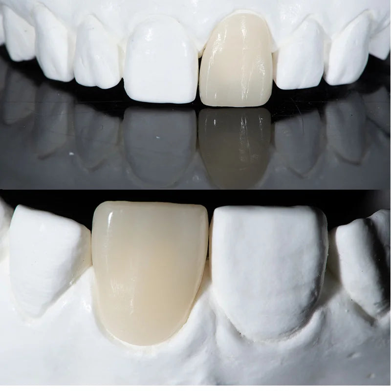 CEREC CADCAM Blocks