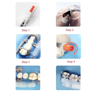 Dental Matrix System Contoured Matrices