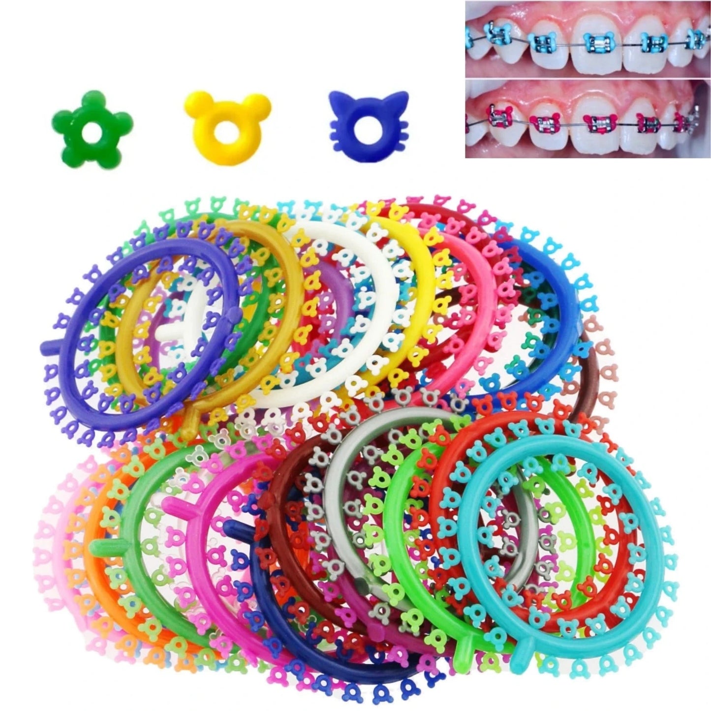 Cartoon Orthodontic Ligature Ties - 1000 Pcs Pack!