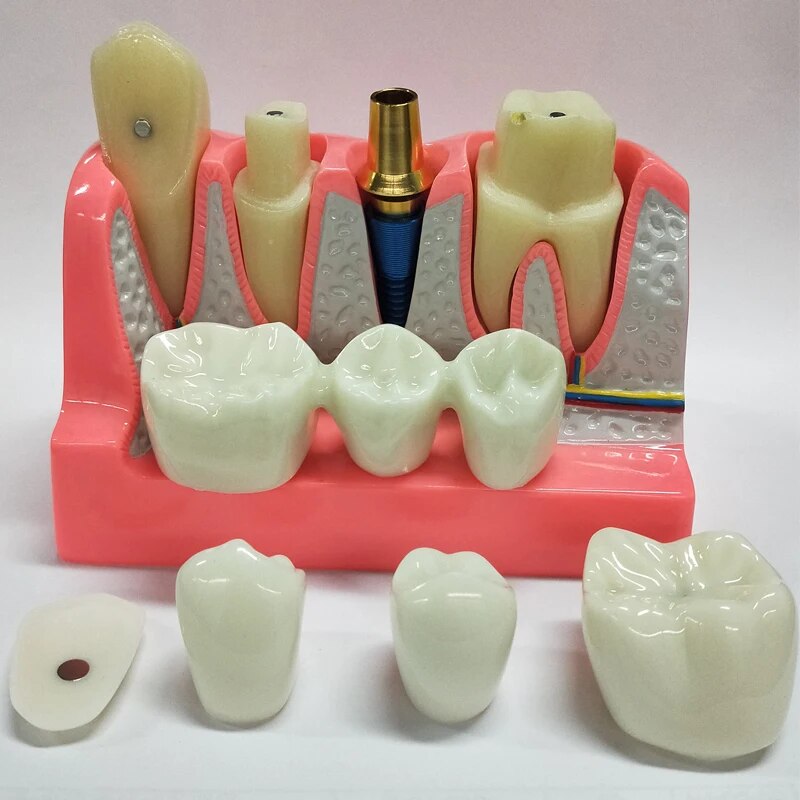 a toothbrush holder with toothpaste and dental instruments