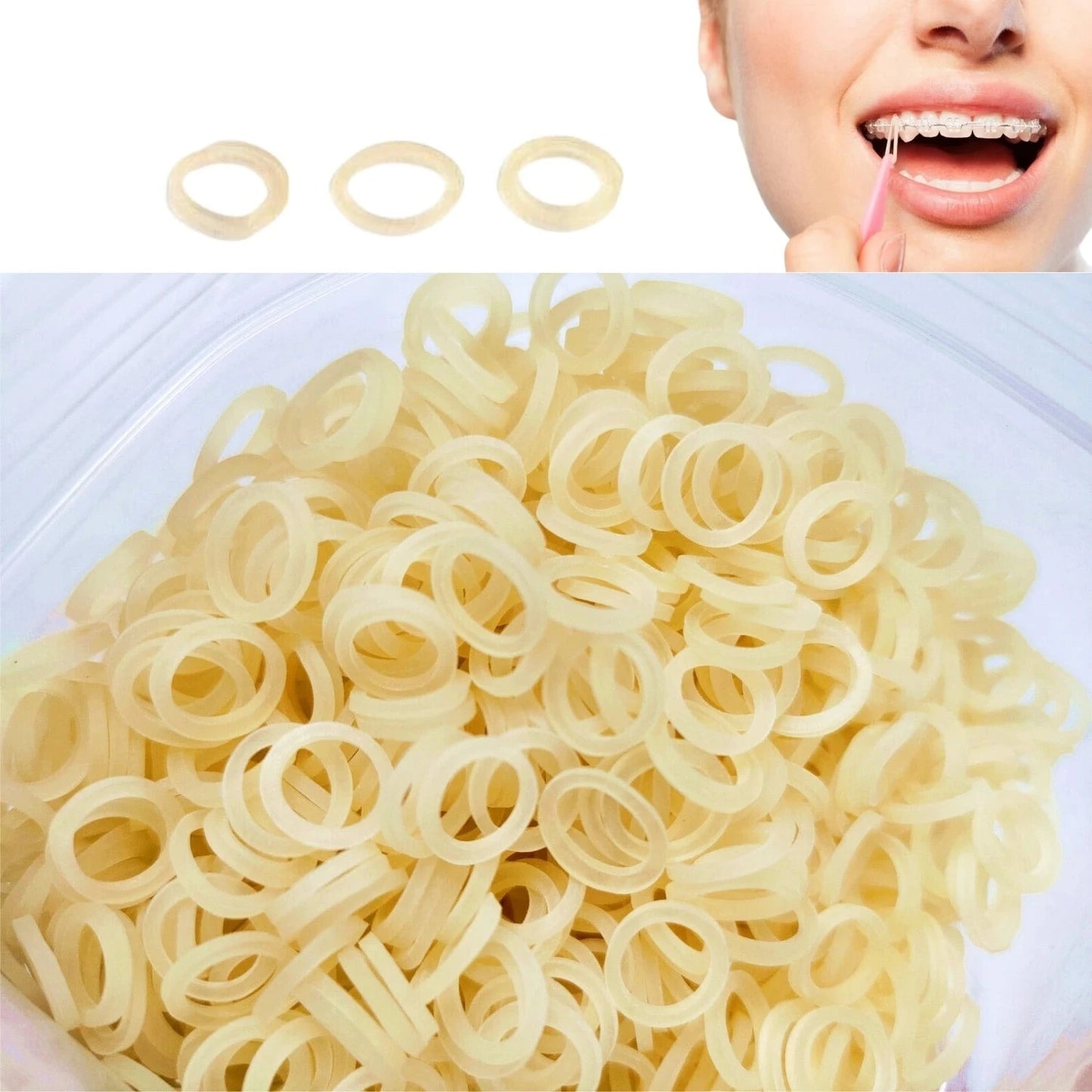 OrthoExtent Orthodontic Intra-Oral Bands - 5000Pcs for Braces