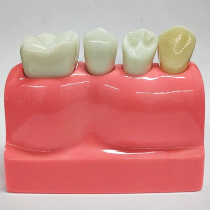 a toothbrush holder with three teeth on it
