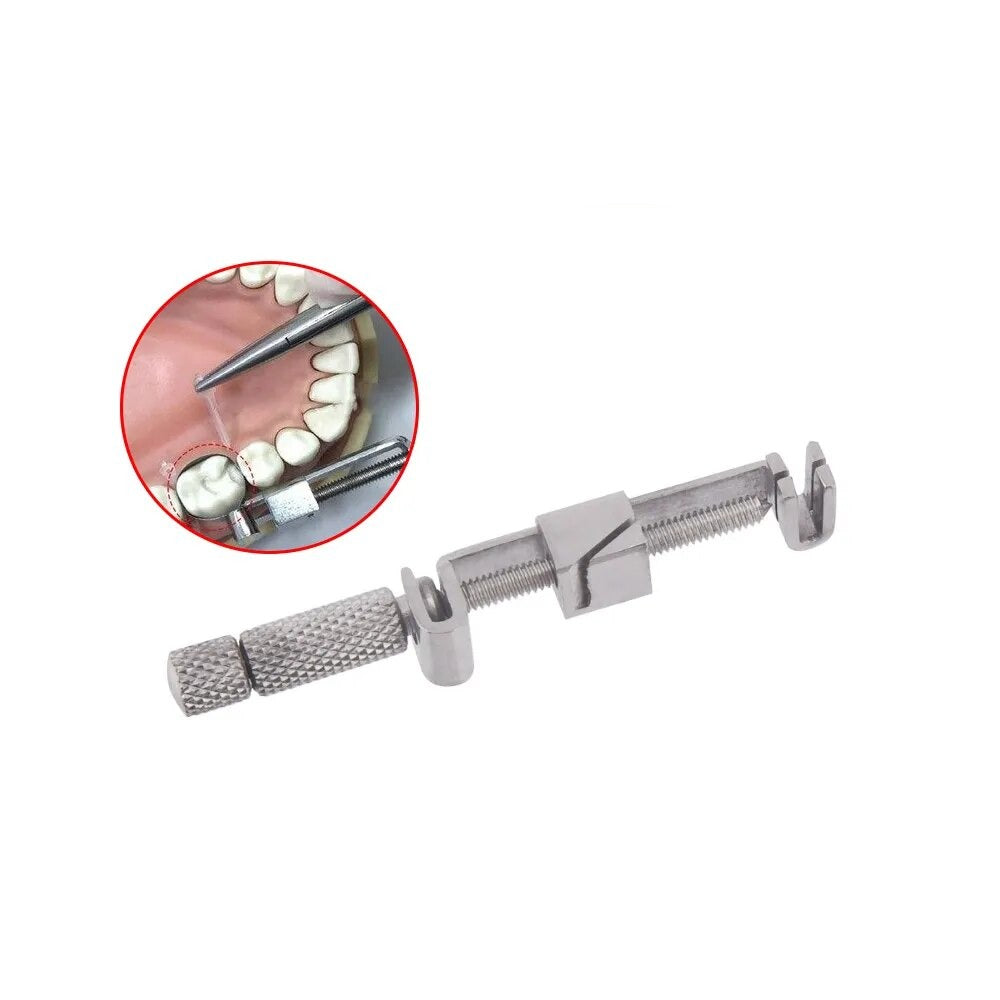Tofflemire Retainers (Universal 4pcs)
