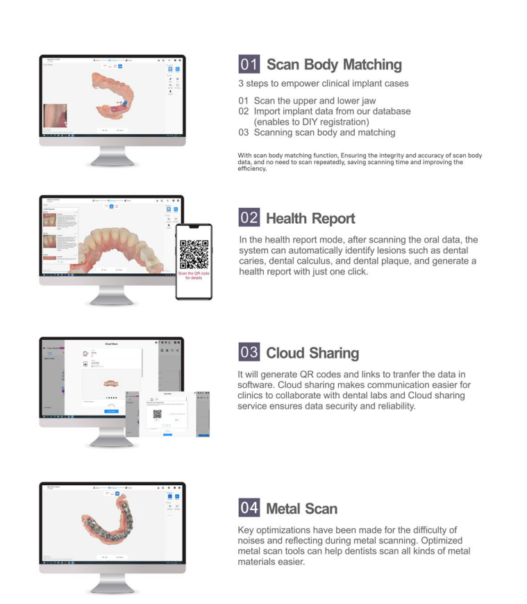 intraoral scanner