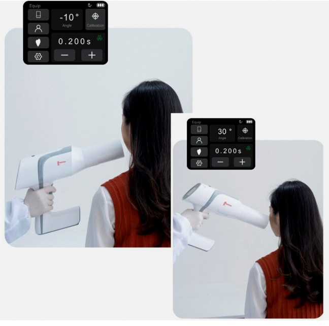 Portable X Ray Unit