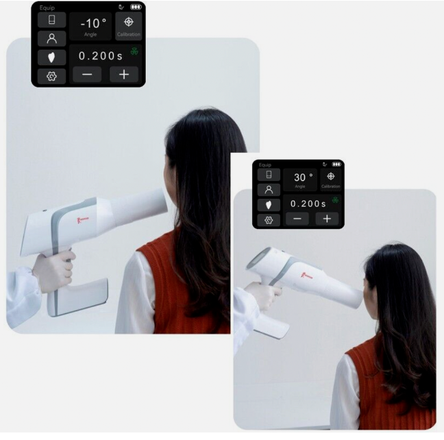 Woodpecker Mini Ai  Portable X Ray  Unit