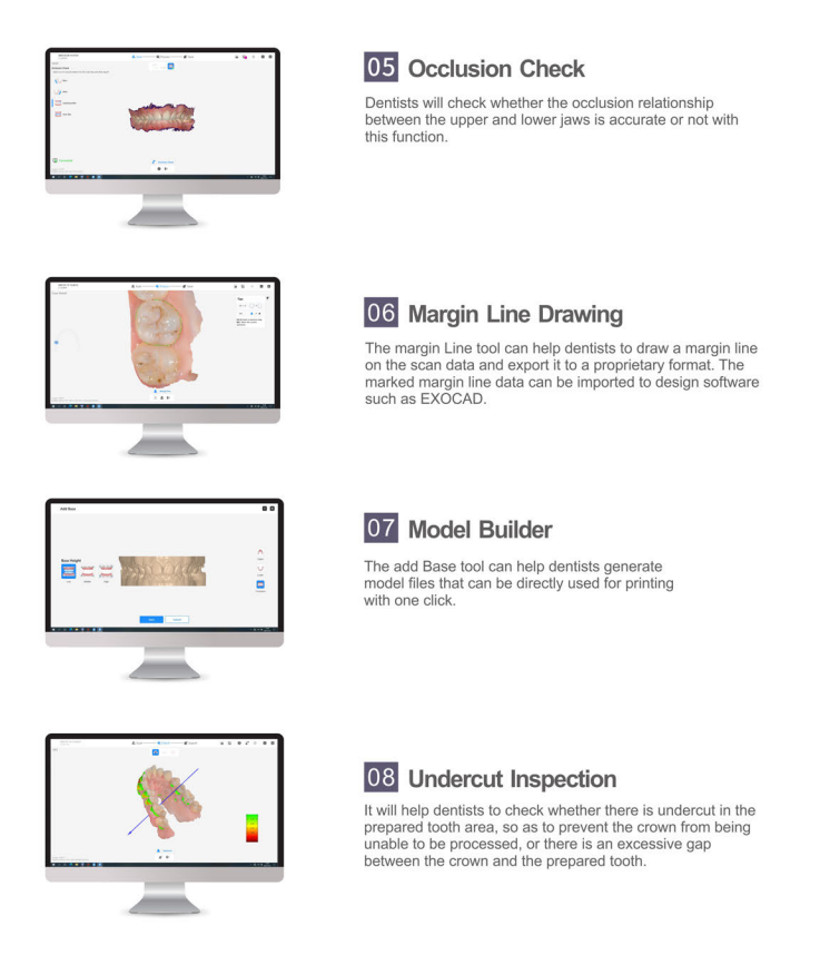 intraoral scanner