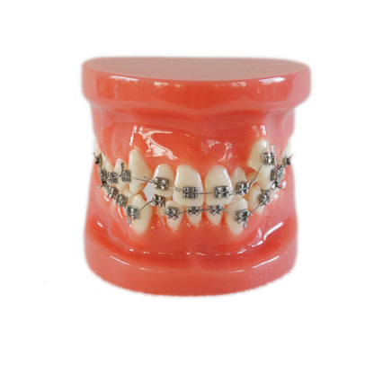 Orthodontic Treatment Model
