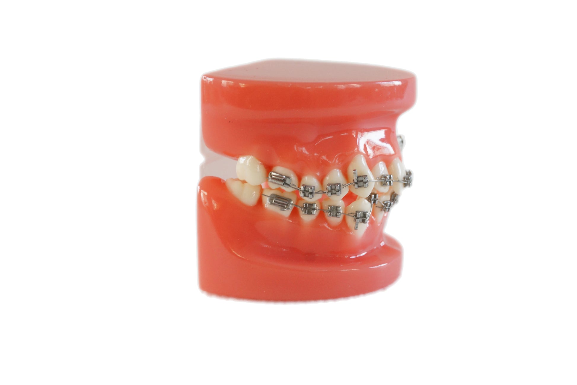 Orthodontic Treatment Model