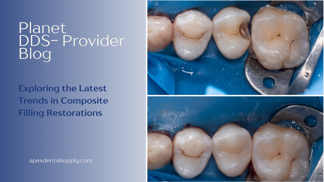  Trends in Composite Filling Restorations -Apex Dental Supply