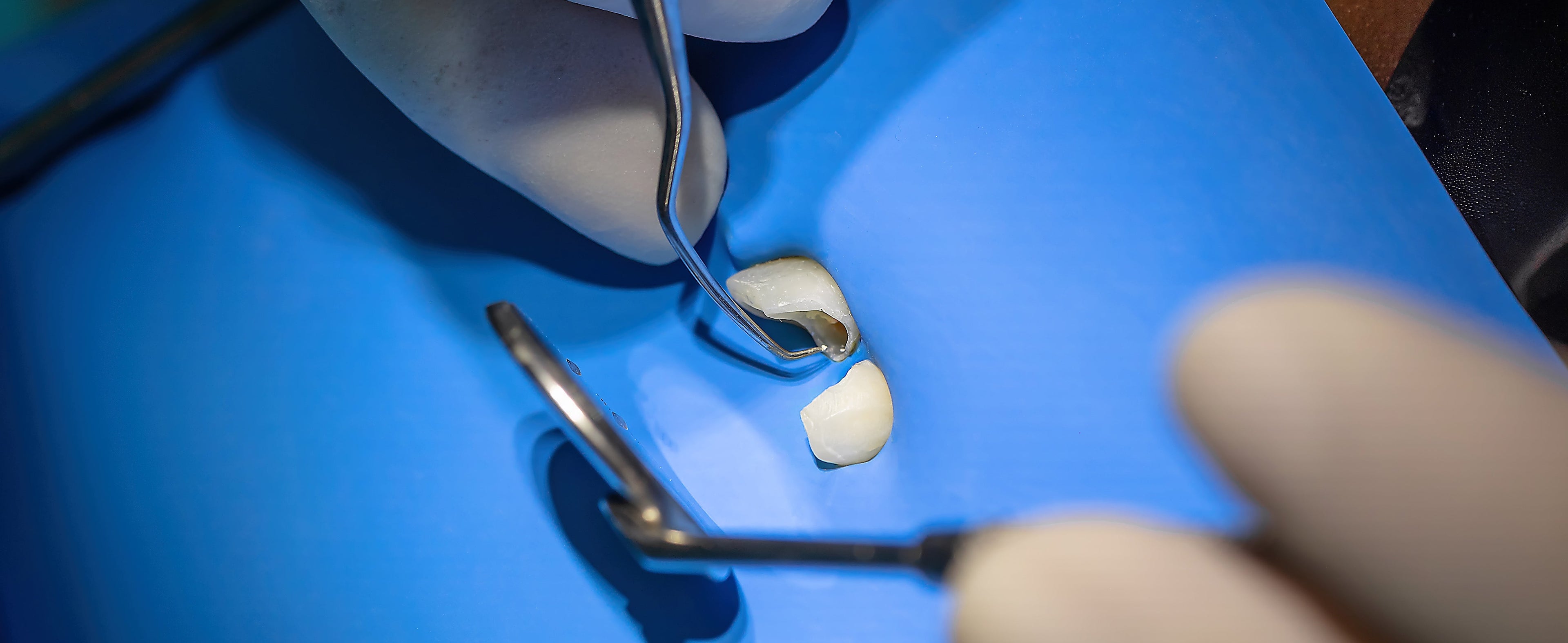 Close-up of dental work with tools and a blue background
