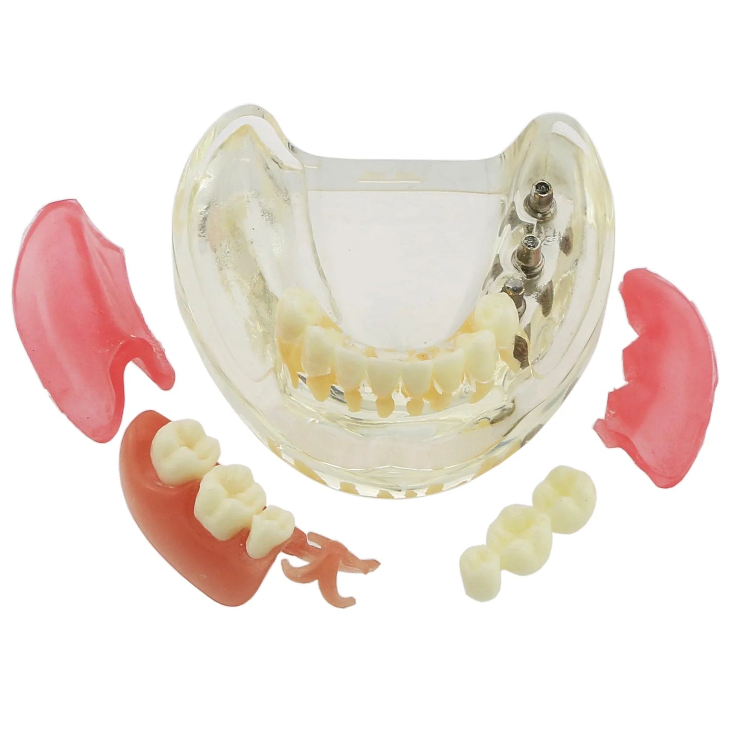 Dental Removable Bridge Partial Tooth Implant Model