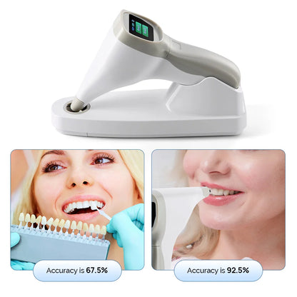 Tooth Shade Color Detector