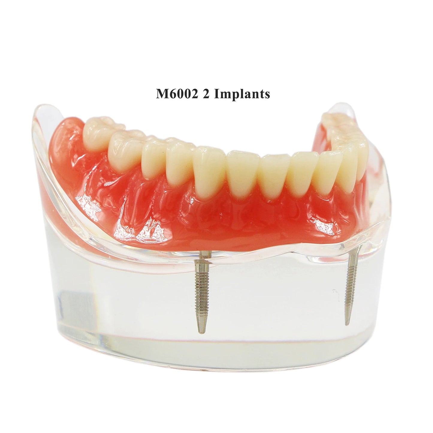 Dental Model M6002 Implant Overdenture Study Base