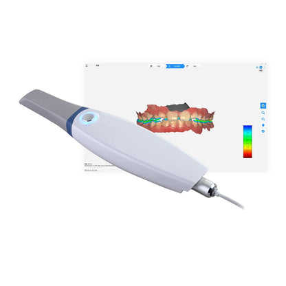Quick Scan Ios QuickScan IOS 3D Intraoral Scanner | Fast & Accurate – APEX DENTAL SUPPLY