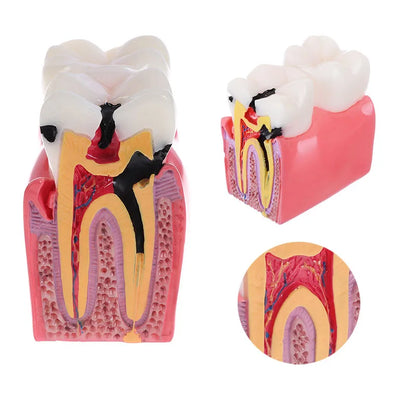 Dental Teeth Model Study Guide