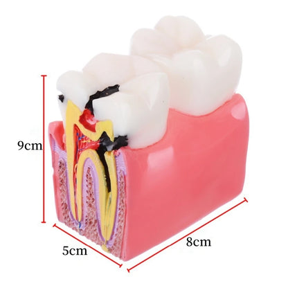 Dental Teeth Model Study Guide