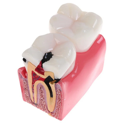 Dental Teeth Model Study Guide