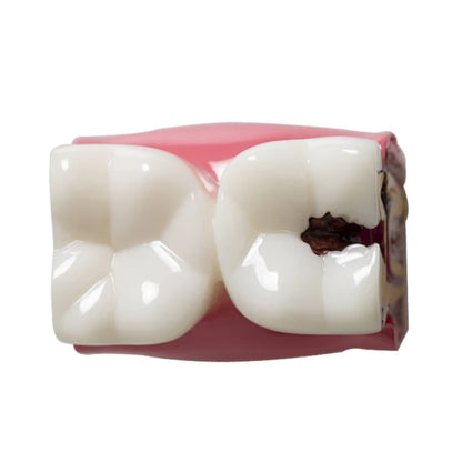 Dental Teeth Model Study Guide