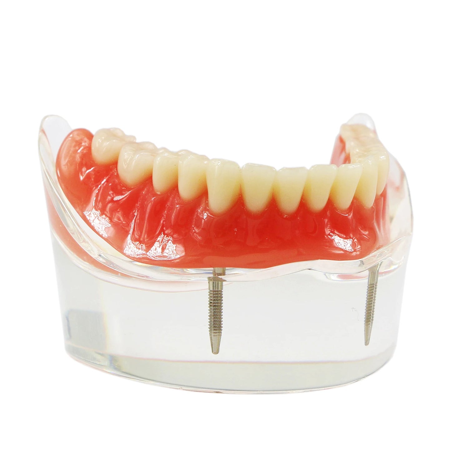 Dental Model M6002 Implant Overdenture Study Base