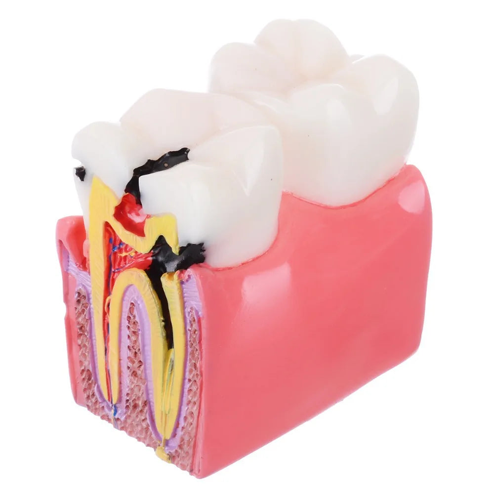 Dental Teeth Model Study Guide