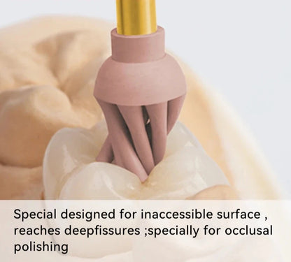 Occlusal Diamond Polishers